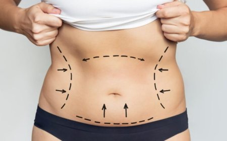 Essential Questions to Ask Before Your Liposuction Surgery in Dubai