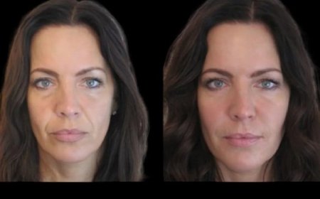 How to Spot the Best Plastic Surgeon in Dubai for Jawline Enhancement