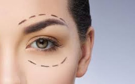 Upper Blepharoplasty in Jeddah: Rejuvenate Tired Eyes with Precision Eyelid Surgery