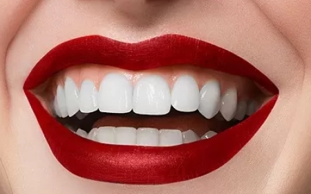 Hollywood Smile Dental Clinic in Dubai: Where Celebrity Smiles Come to Life