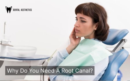 How Much Does a Root Canal Cost? A Guide for Patients in Lahore