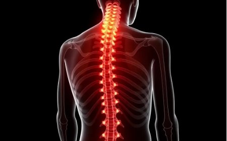 Low Back Pain Specialist in NJ