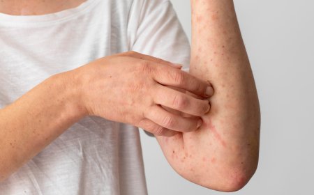 How Can a Family Allergist Help Manage Your Allergies?